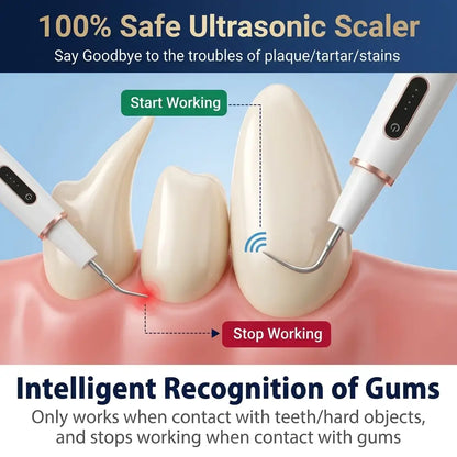 Ultrasonic scaler tool with teeth and gums illustration, highlighting safe usage and intelligent recognition of gums.